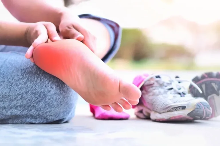 What We Want Athletes to Know About Plantar Fasciitis