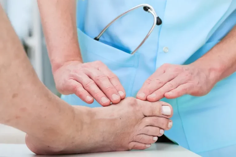 Is Surgery the Best Solution for Bunions?