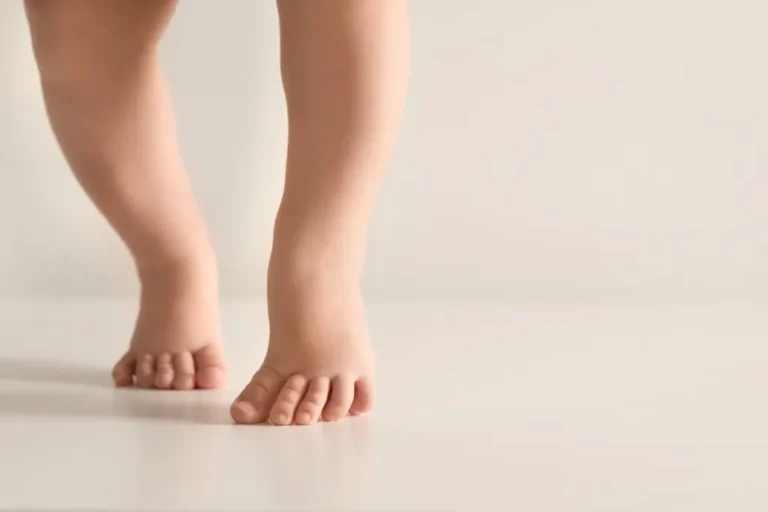 3 Common Gait Issues in Children