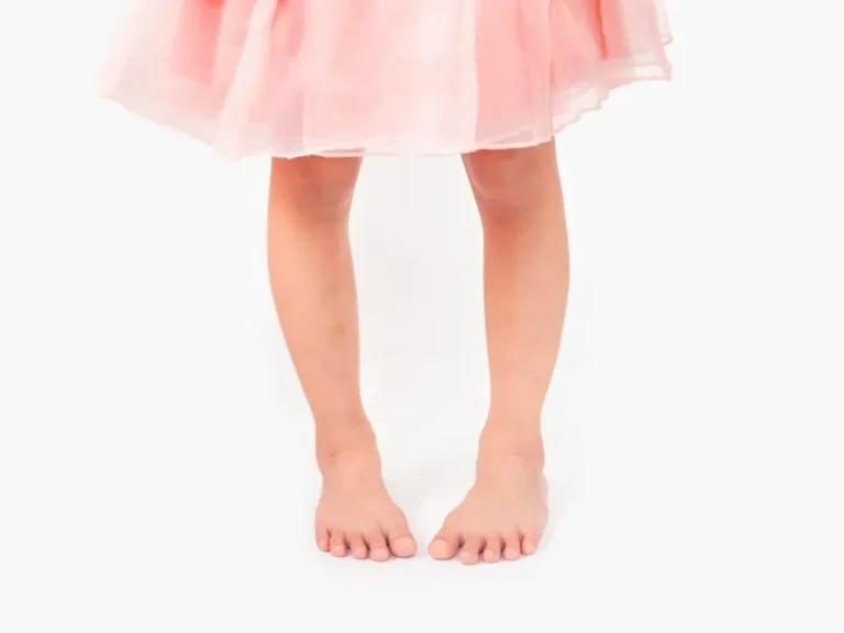 My Child Walks With Their Toes Pointed Inward: Should I Worry?